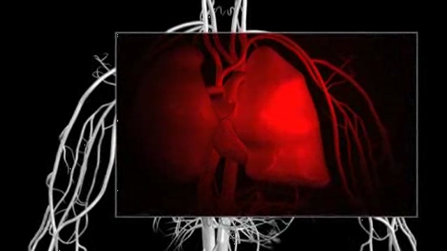Metastatic eye disease Thumbnail