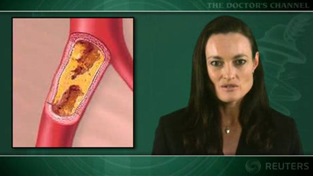 Other statins – not just atorvastatin – can reduce plaque volume in ACS Thumbnail
