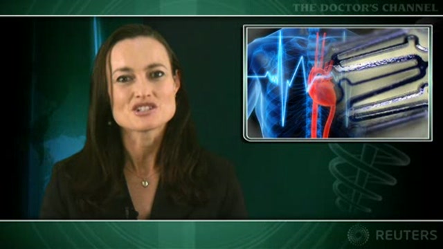 Adding PCI to medical therapy does not alter stable CAD outcome Thumbnail