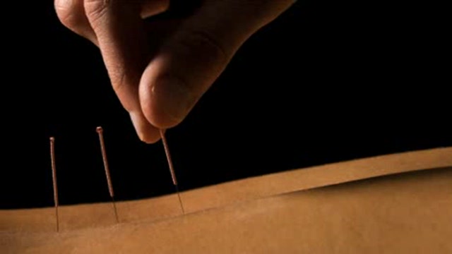 Acupuncture for doctors Thumbnail