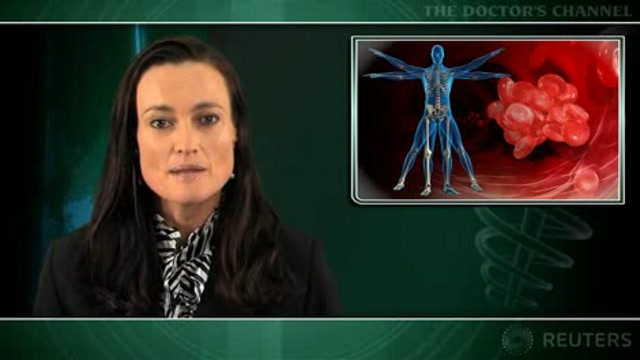 Extended travel may not be a risk factor for symptomatic thromboembolism Thumbnail