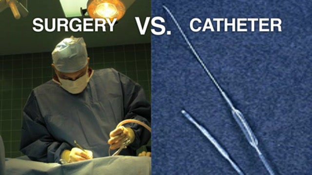 Cathether – based aortic valve replacement Thumbnail