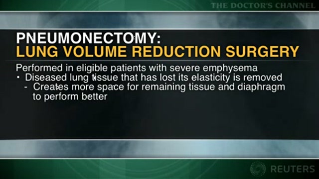 Lung reduction surgery improves quality of life with emphysema Thumbnail