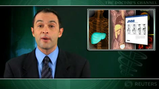 PET testing reduces futile resections for colorectal liver metastases Thumbnail