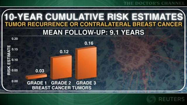 Follow-up after grade 1 breast cancer may not be needed Thumbnail