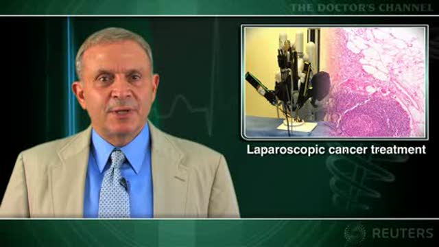Laparoscopy vs open surgery for rectal cancer: similar results Thumbnail
