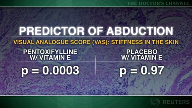 Pentoxifylline/vitamin E combo may prevent some radiation side effects Thumbnail