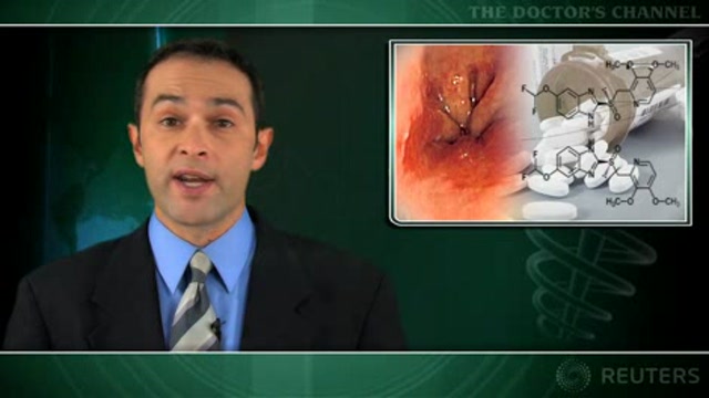 Long-term therapy with proton pump inhibitors appears safe Thumbnail