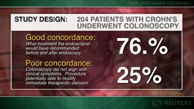 Colonoscopy findings usually not needed for Crohn’s treatment decisions Thumbnail