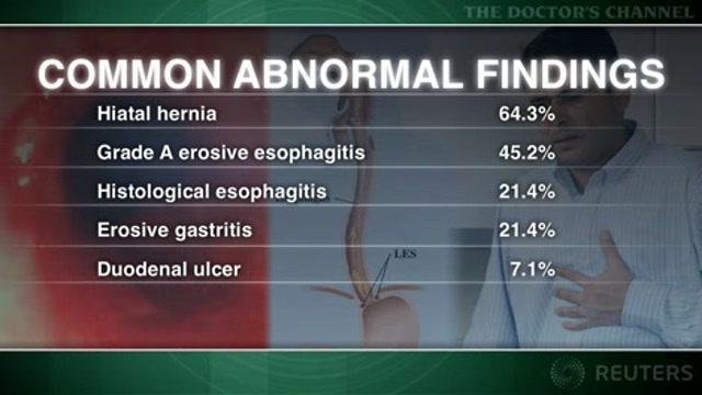 GI tract findings common with snoring, with or without OSA Thumbnail