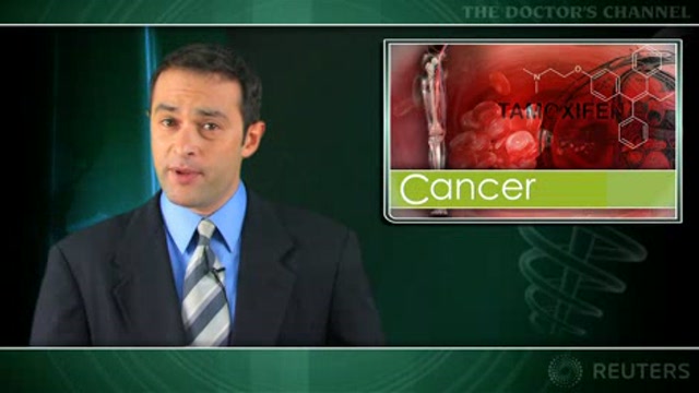 Thrombosis risk with tamoxifen highest during first two years of treatment Thumbnail