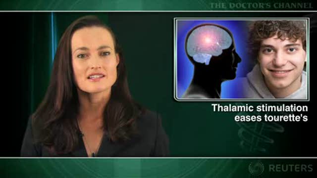 Deep brain stimulation shows promise for Tourette’s syndrome Thumbnail