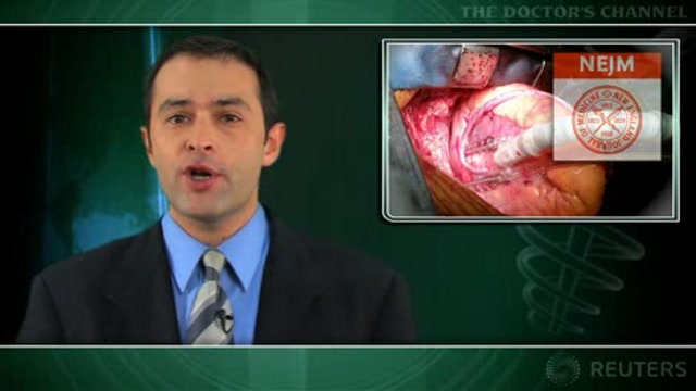 Newer CABG surgery actually linked to worse outcomes Thumbnail