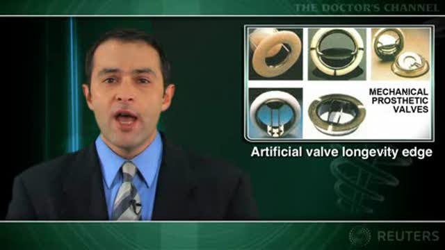 Biological aortic valves fail more often than mechanical valves Thumbnail