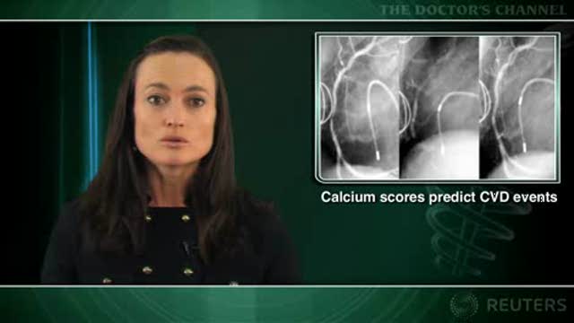 Little or no coronary calcification means low risk of cardiovascular events Thumbnail