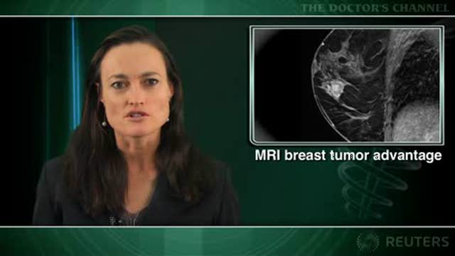 Breast MRI best for finding mammographically occult cancers Thumbnail