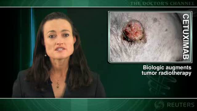 Cetuximab benefit for head and neck cancer persists at 5 years Thumbnail