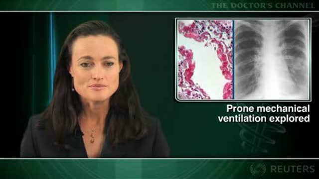 No significant survival benefit with prone positioning for ARDS patients Thumbnail