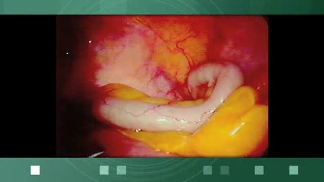 The Appendix Thumbnail