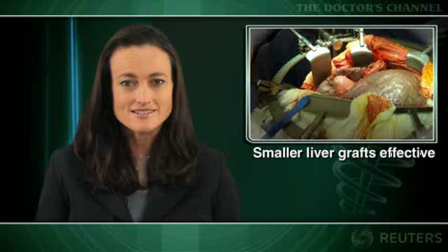 No drop in survival seen with smaller living donor liver grafts Thumbnail