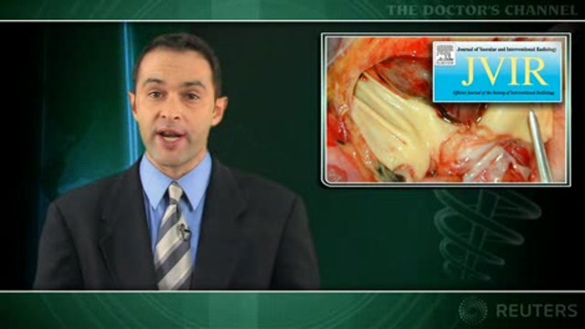 Catheter-directed therapy safe and effective for massive pulmonary embolism Thumbnail