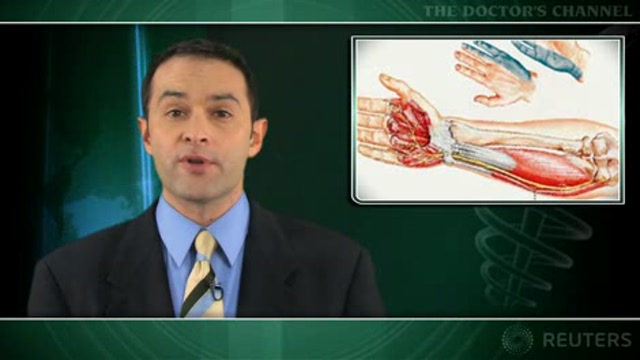 Provocative tests cannot diagnose ulnar neuropathy at elbow Thumbnail