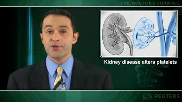 Clopidogrel response decreased with chronic renal failure Thumbnail