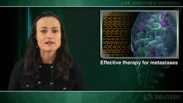 Trastuzumab prolongs survival in HER2+ metastatic breast cancer Thumbnail