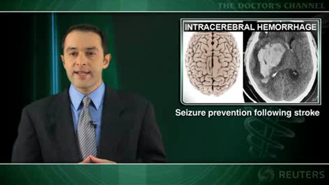 Phenytoin linked to worse outcomes after intracerebral hemorrhage Thumbnail