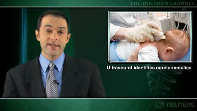 Ultrasound screening for tethered cord syndrome useful in infants with mid- or high-risk signs Thumbnail