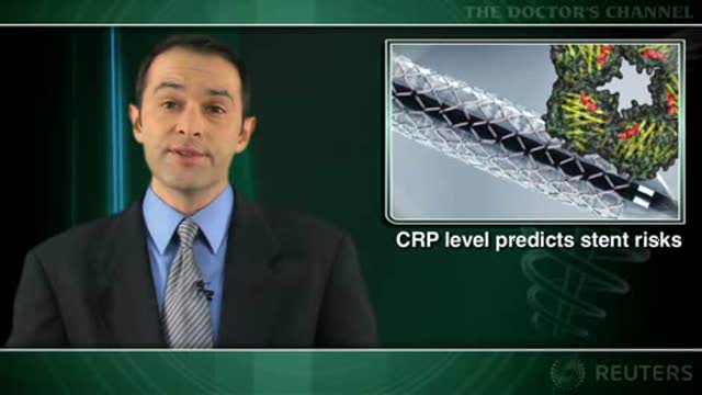 High CRP predicts worse outcome after drug-eluting stent placement Thumbnail