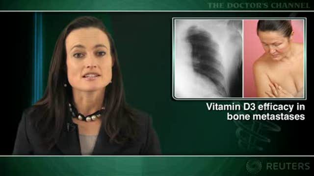 High-dose vitamin D safe for metastatic breast cancer, but benefits questionable Thumbnail