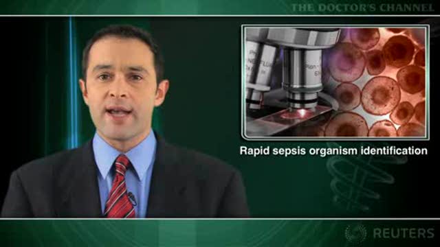 New DNA test much faster than culture in identifying sepsis pathogens Thumbnail