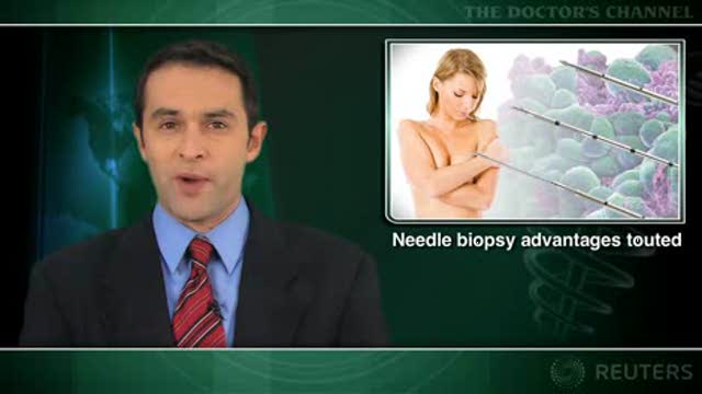 Core needle biopsy nearly as good as open biopsy for diagnosing breast lesions Thumbnail