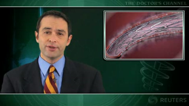 Diabetics do better with sirolimus-eluting stents Thumbnail