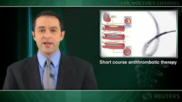 Post-stenting clopidogrel guidelines may be excessive Thumbnail