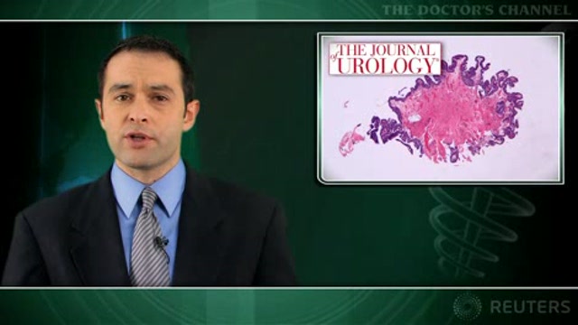 Guidelines for work-up of dipstick hematuria are often ignored Thumbnail