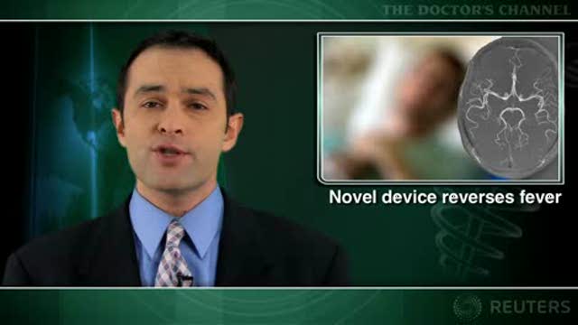 Catheter-based normothermia cuts fever in patients with cerebrovascular disease Thumbnail