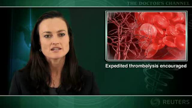 Unsuspected coagulopathy seldom prevents stroke thrombolysis Thumbnail