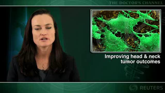 Adverse events common with chemoradiation for head and neck cancer Thumbnail
