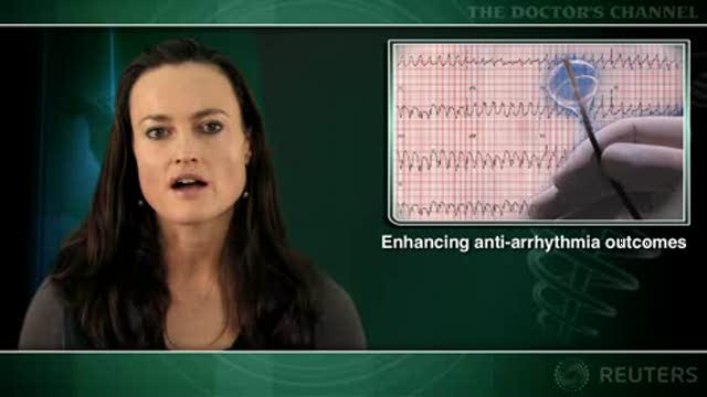 Catheter ablation before defibrillator placement helps cut arrhythmia recurrence Thumbnail