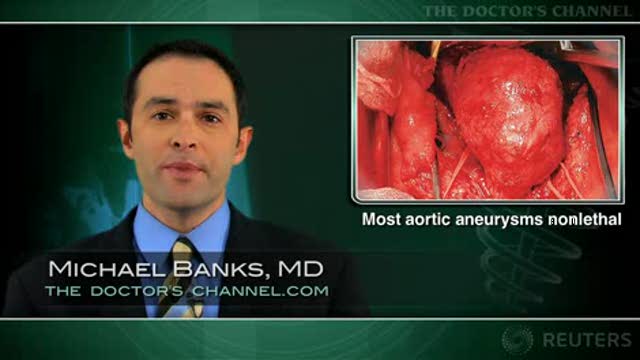 Growth rate of small abdominal aortic aneurysms predicts need for intervention Thumbnail