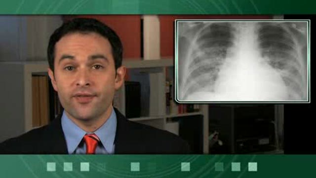 Diffuse Lung Disease In Infancy Thumbnail