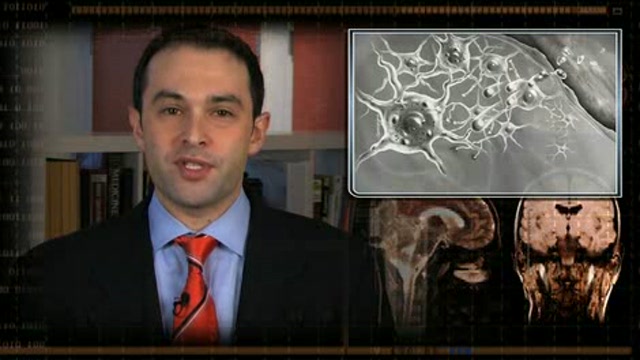 From VerusMed Neurology  January 30, 2008 Thumbnail