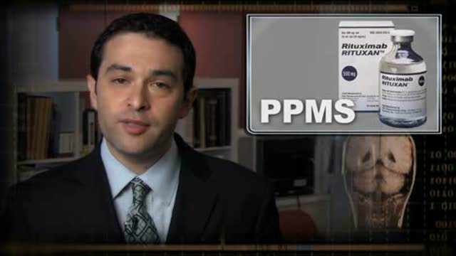 PPMS: Rituximab Fails At Primary Endpoint Thumbnail