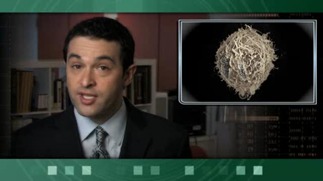 Lipitor and Celebrex: Inhibition of Androgen-Independent Prostate Cancer Thumbnail