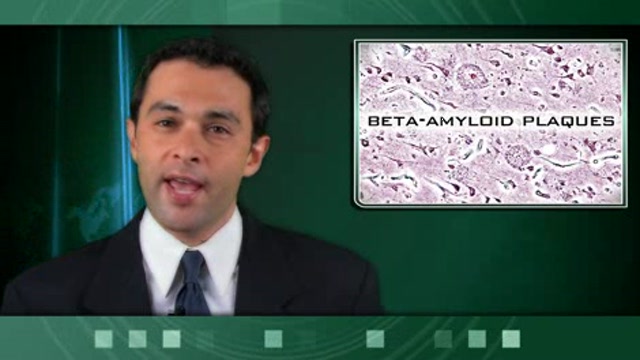 Diabetes Drug Combo May Protect Against Alzheimer’s Disease Thumbnail