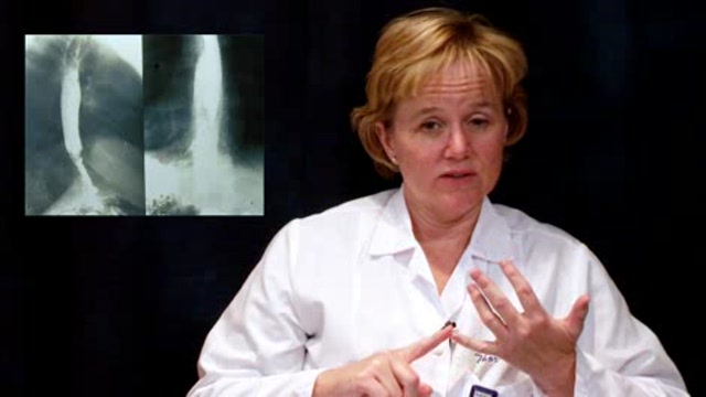 Esophageal Cancer Thumbnail