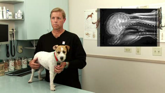 Syringomyelia Thumbnail