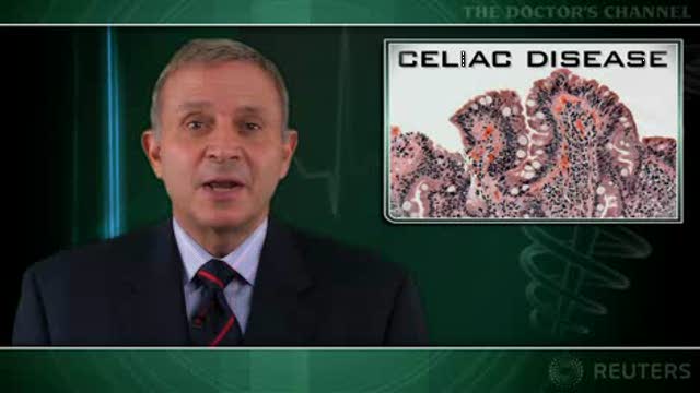 Bone metabolism defects common in untreated children with celiac disease Thumbnail